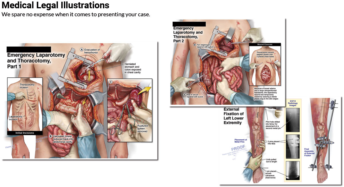 Illustration-Case-A-Results-Page